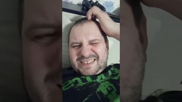 Приколы. Удаление На Голове Волос Пласкогубцами.