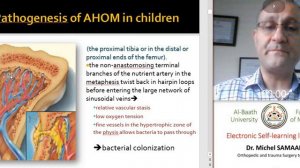 Bone infections 1 Acute haematogenous Osteomyelitis