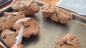 Белое вещество полушарий головного мозга (3 группы)