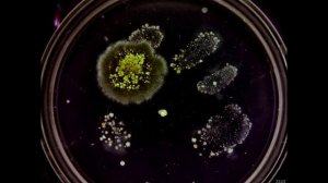 Рост бактерий с немытой руки