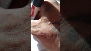 "сосёт под ложечкой", мало кто знает,что это значит!