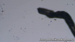 Волос человека под микроскопом