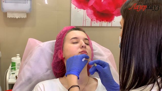 Ін'єкції Ботоксу та Диспорту смотреть онлайн