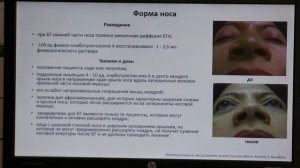 ТОКСИН. СУЖЕНИЕ НОСА(фрагмент)