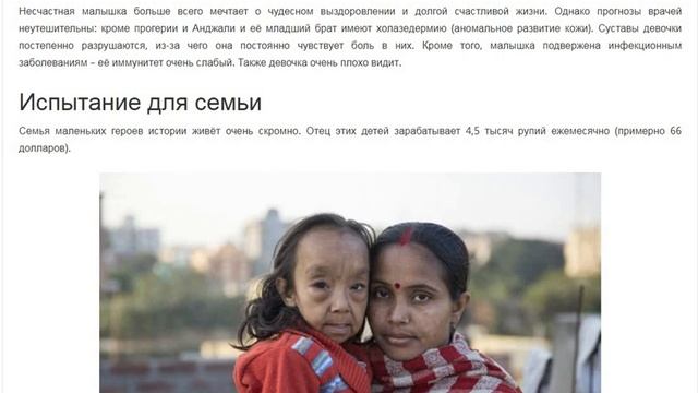 Индийские дети-старики : Моя Ужасная История смотреть онлайн