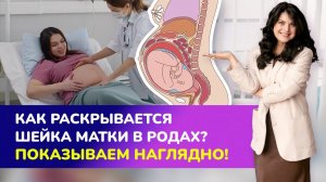 Как раскрывается шейка матки в родах? 👍🏻ПОКАЗЫВАЕМ НАГЛЯДНО!