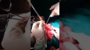 Удаление паразитов у человека