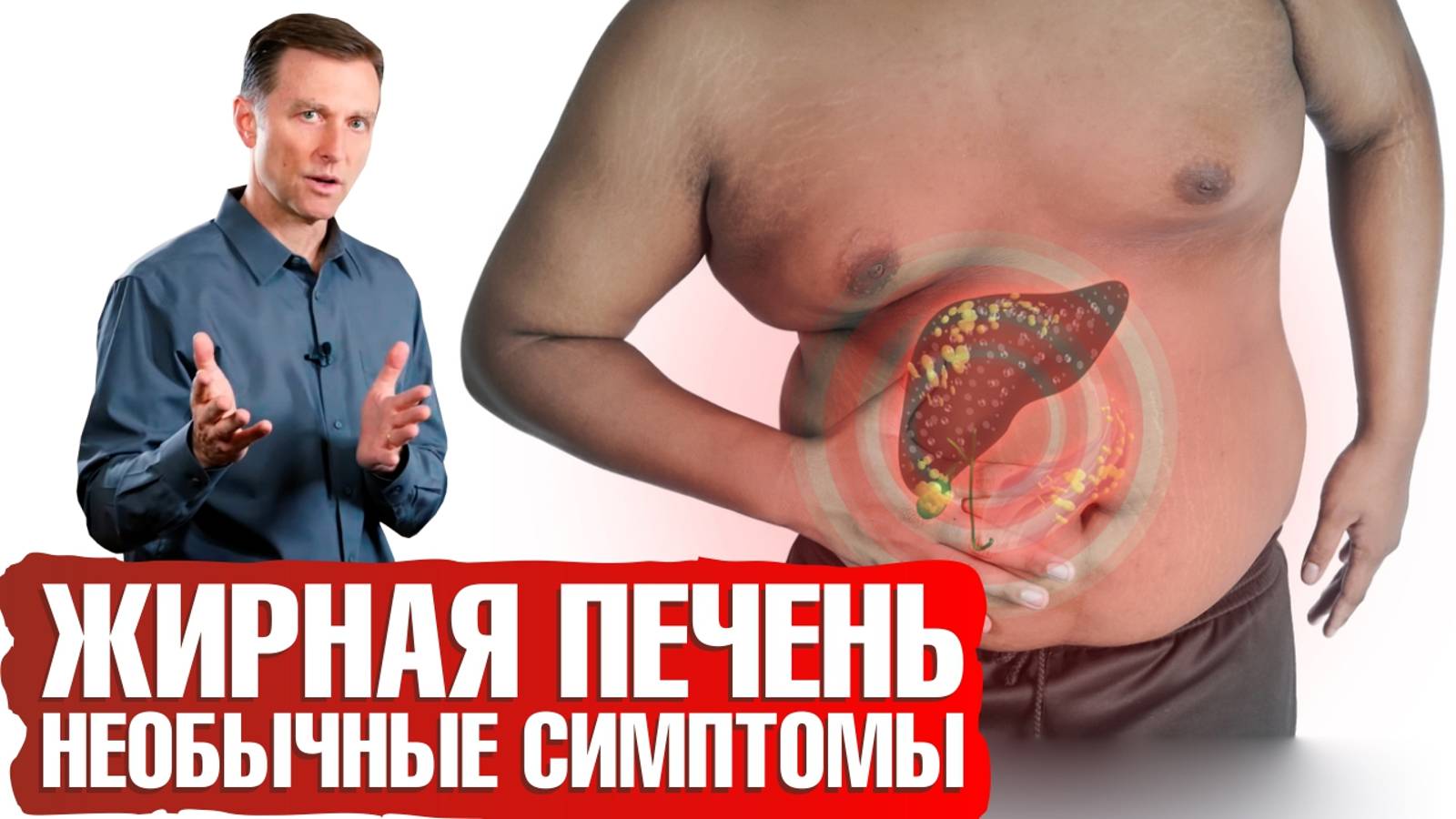 Симптомы жировой печени (жировой гепатоз): вы бы и не подумали, что дело в печени...😨