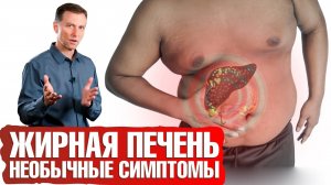 Симптомы жировой печени (жировой гепатоз): вы бы и не подумали, что дело в печени...😨