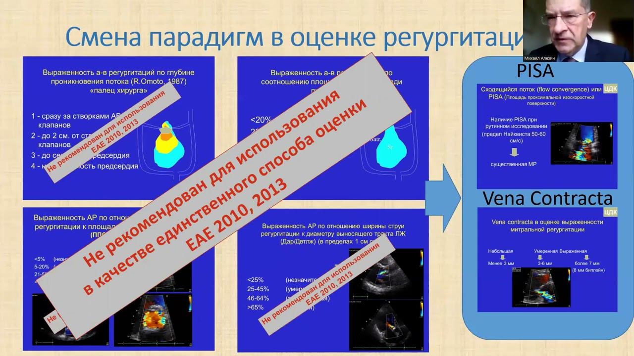 22.10 Научный симпозиум «Что нового в эхокардиографии- 2022»