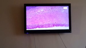 Гистология Двенадцатиперстная Тощая Толстая кишка Аппендикс [Пищеварительная система]