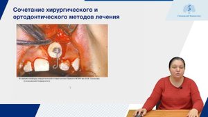 Болезни прорезывания зубов. Часть 2