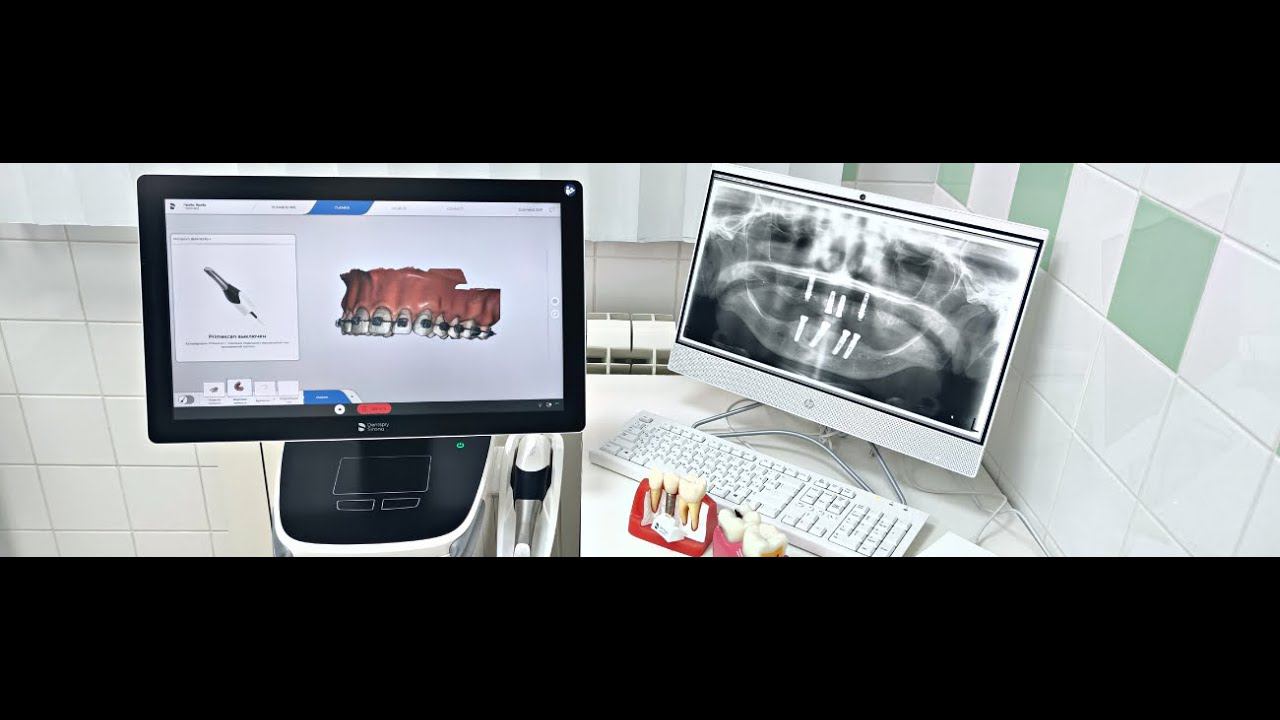 Внутриротовой 3D-сканер Primescan от Dentsply Sirona