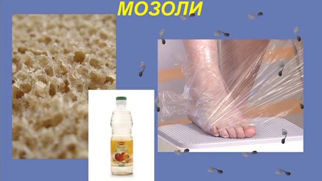 Как убрать мозоли смотреть онлайн