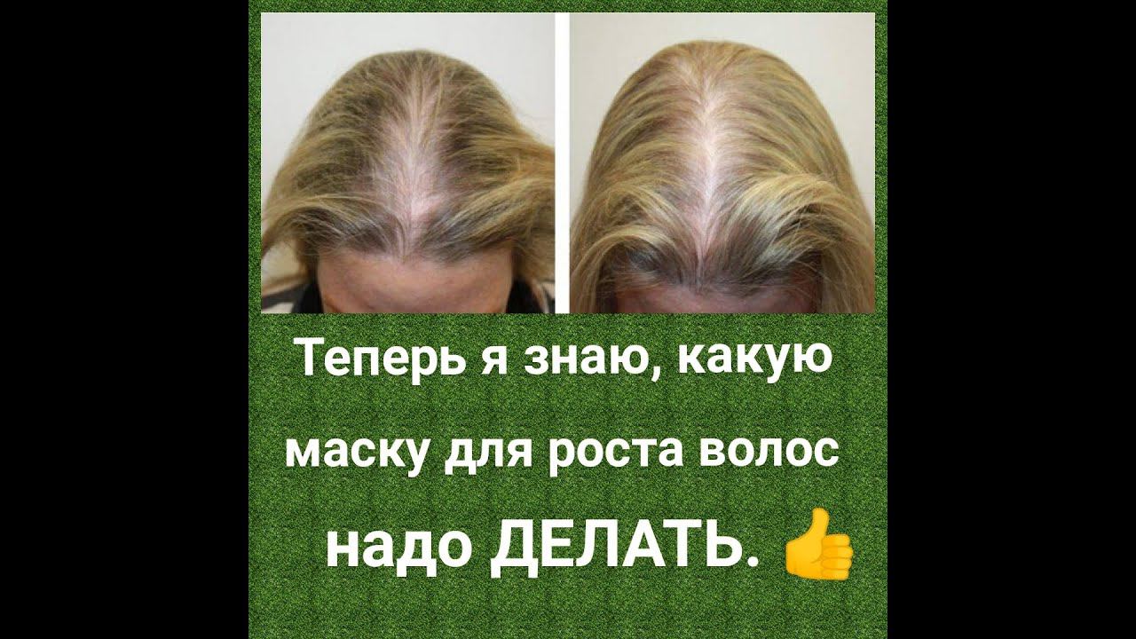 Супер маска для РОСТА ВОЛОС и против ВЫПАДЕНИЯ.