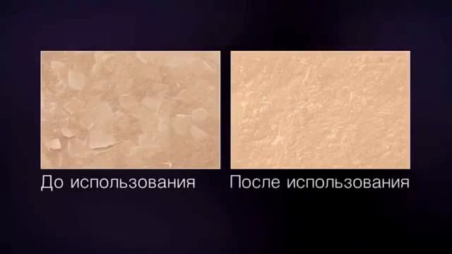 Эпилятор Braun SE 7931/7951 Spa смотреть онлайн