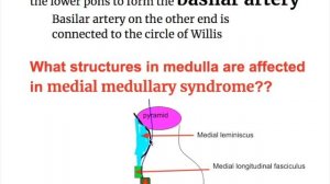 Lateral VS medial medullary syndrome