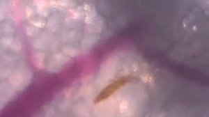 Как кусает комар. Макросъемка. Как защититься от комаров в лесу (ссылка под роликом)