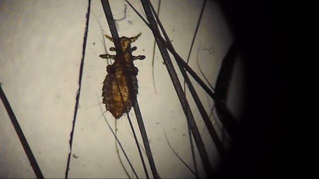 Живая вошь крысиная смотреть онлайн