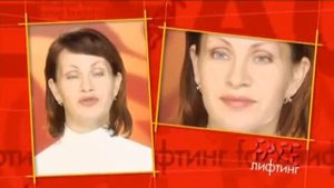 19 Фейслифтинг (facelifting) от Галины Дубининой: точечный массаж лица