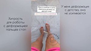 Упражнение при вальгусной деформации стоп.