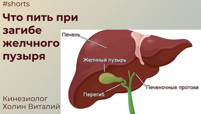 Что пить при загибе желчного пузыря