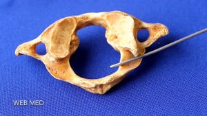 Первый шейный позвонок Atlas