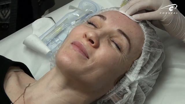 Ни массаж ни уход не дадут таких результатов, как биоревитализация смотреть онлайн