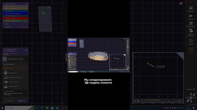 Сплинт-терапия. Как моделируют сплинт в зуботехнической лаборатории