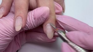 Очень кривой ноготь Как исправить ноготь растущий в сторону Дизайн ногтей кошачьим глазом