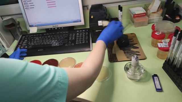 Бактериологический посев в лаборатории, как подготовиться, зачем нужно, и что вы получите в итоге.