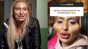 Анастасия Покрищук, блогерша с большими скулами до пластики