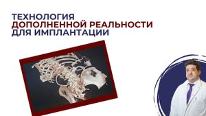 Технология дополненной реальности для имплантации