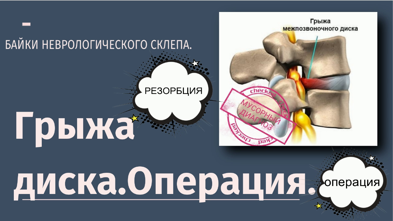 Операция диска