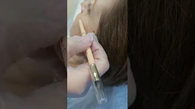 АирисКом студенты учатся: семинар по филлерам увеличение скуловой области.