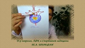Может ли грыжа позвоночника "рассосаться"?