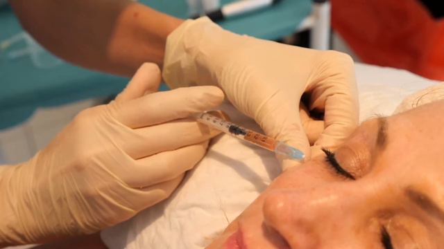 Chapter 20.1: Use of PRF in Facial Esthetics presented by Dr. Catherine Davies смотреть онлайн