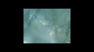 Как ползает личинка мухи под микроскопом