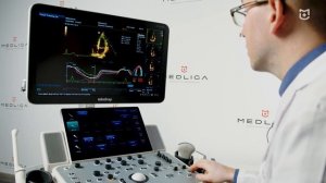 Автоматический расчет фракции выброса и лонгитудинальный стрейн на Mindray DC-60 Pro