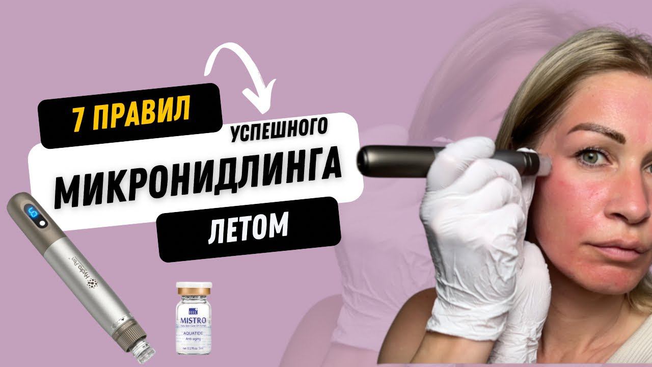 7 правил успешного микронидинга летом