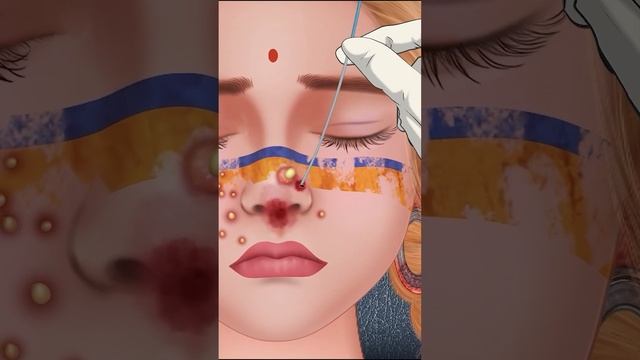 ASMR Treatment and cleaning of nose piercings infected with necrosis . Episode 1