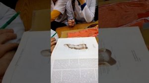 Прямая кишка Анатомия