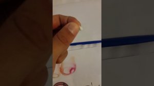 Вросший ноготь на ноге лечение в домашних условиях Ч:1