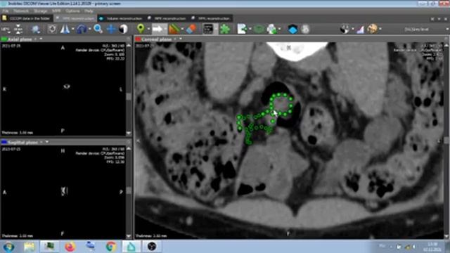ЗАВОРОТ . НА ОСНОВАНИИ КАКИХ ДАННЫХ , ДЕЛАЕТСЯ ТАКОЙ ВЫВОД . смотреть онлайн