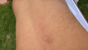 Роули для Спины, очередная разработка Madesto-Lab. Мадеротерапия.