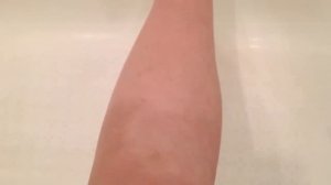 Эпилятор Philips и я: до и после )