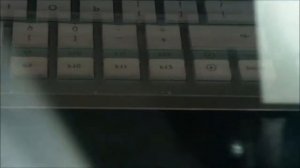 Бюгельный протез и мостовидный протез методом селективного спекания