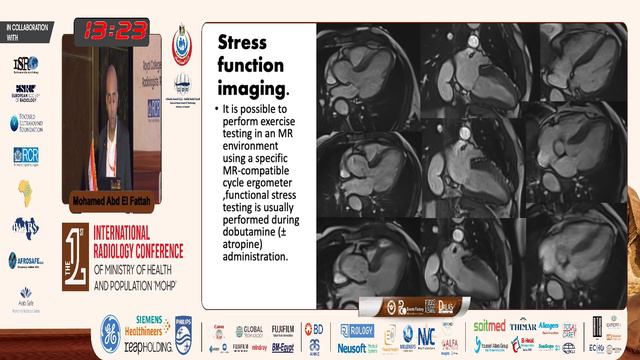 Introduction to Cardiac MRI Protocols and Sequences