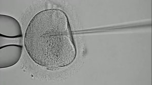 Как делают искусственное оплодотворение?