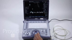GE Logiq e Training Part 4: Doppler Mode and M-Mode